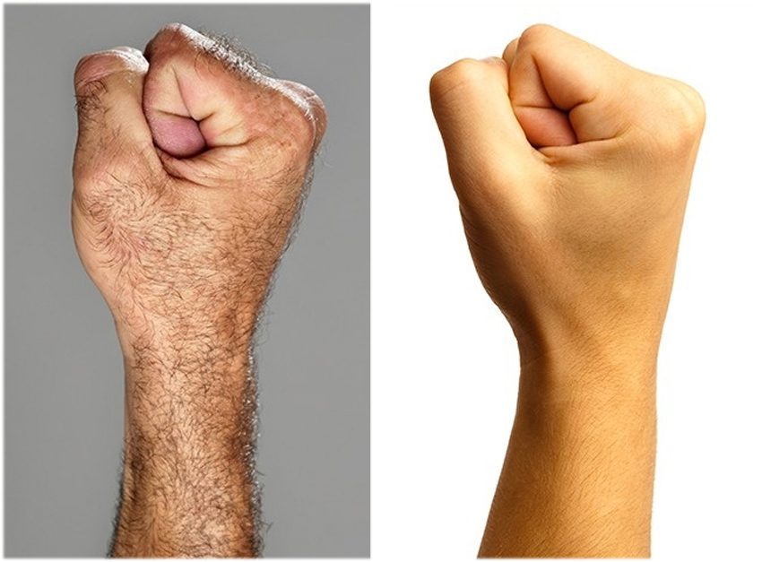 5. Vi blir mindre håriga. Vi är betydligt mindre håriga än våra förfäder. De enda ställena där det inte har blivit några förändringar är på vårt huvud och i armhålorna.
