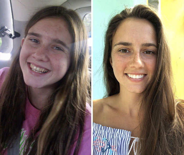 12. 15 vs 23 år