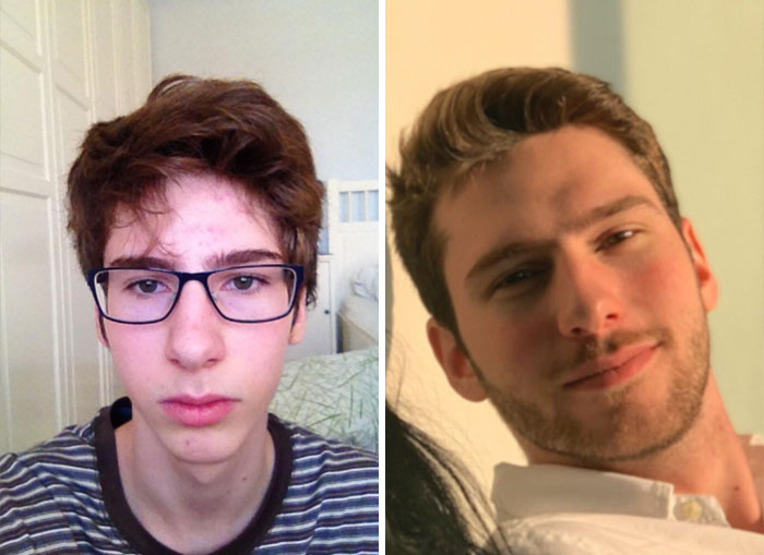 5. 16 vs 20 år